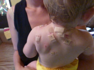 w with poysporin after